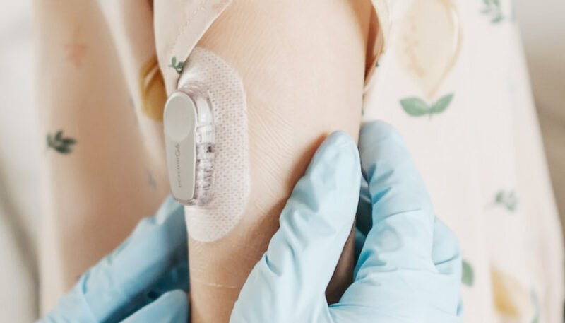 These adhesive solutions enable microfluidic chip cover bonding, channel isolation, and reagent protection, and are commonly used in blood glucose meters, rapid test cards, and nucleic acid testing equipment.